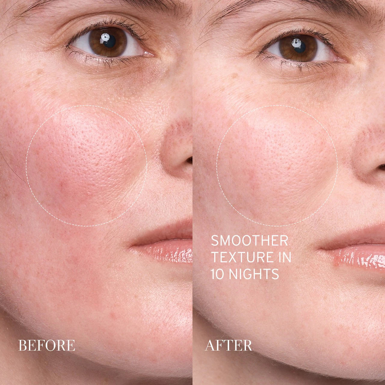 Serum - Lotus AHA Resurfacing Gentle Serum