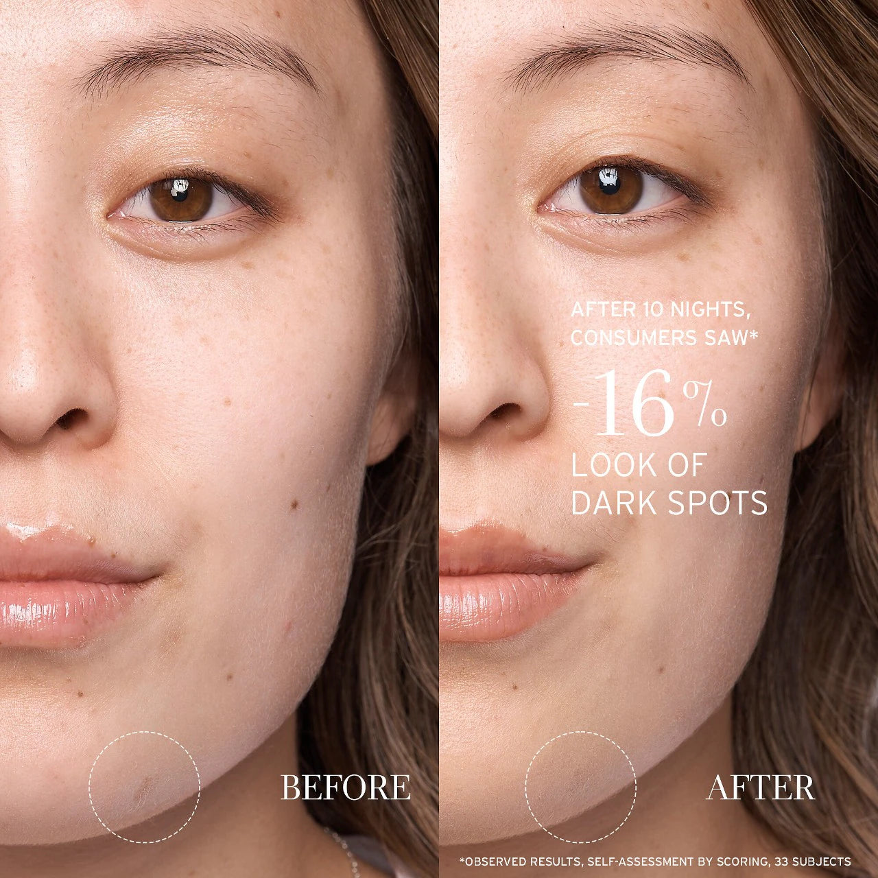 Serum - Lotus AHA Resurfacing Gentle Serum