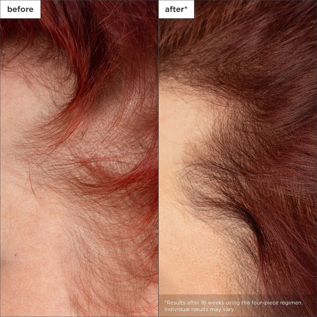 Shampoo - Destined For Density™ Peptide Shampoo for Thicker, Fuller Hair